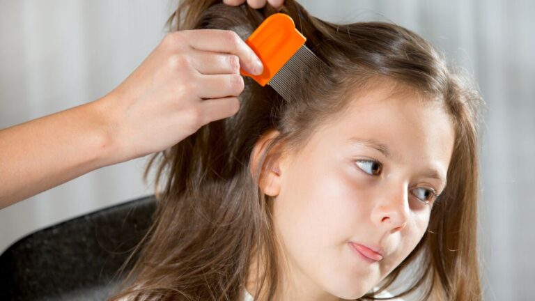Gros plan sur des lentes accrochées aux cheveux, facilitant leur identification.
