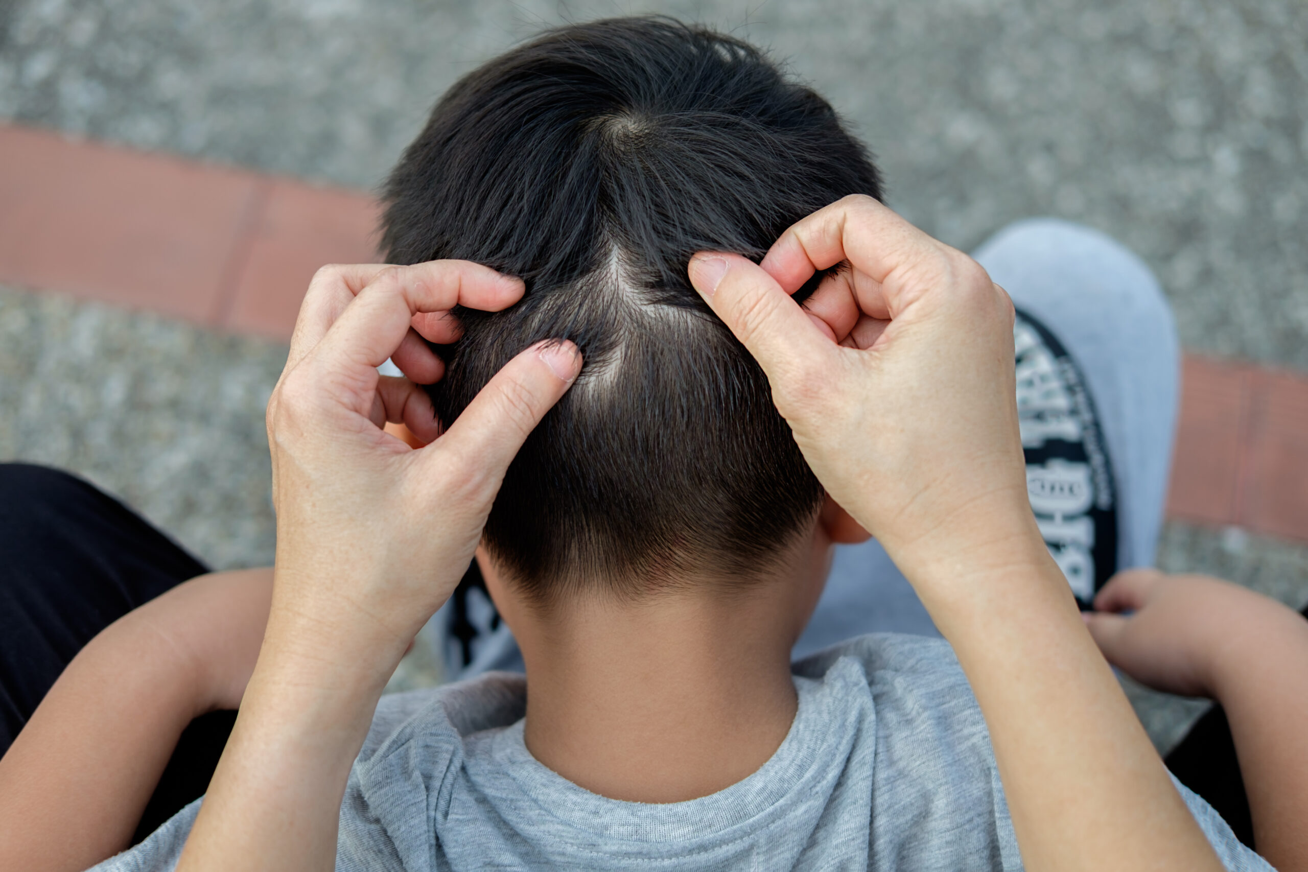 Lentes sur cheveux