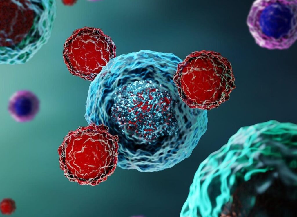Cancer incurable : quels sont les types les plus fréquents ?