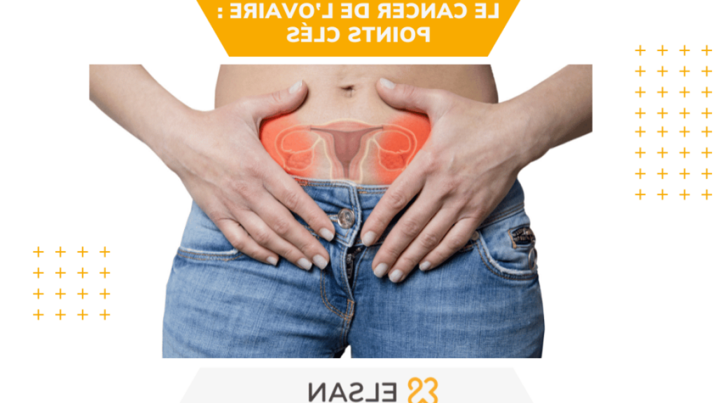 Quels sont les 8 signes du cancer des ovaires ?