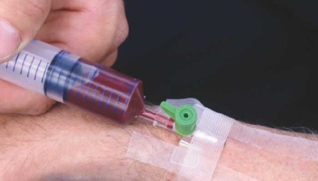 Témoignages sur la survie avec seulement 1 litre de sang : est-ce possible ?