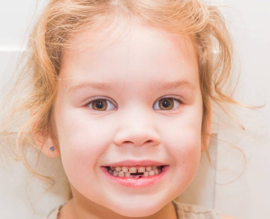 Combien de dents de lait possède un enfant avant de les perdre ?
