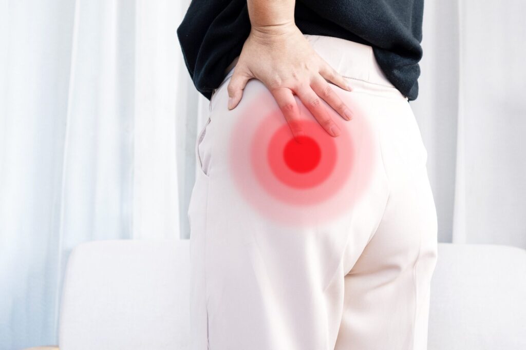 Comment diagnostiquer une fessalgie ?