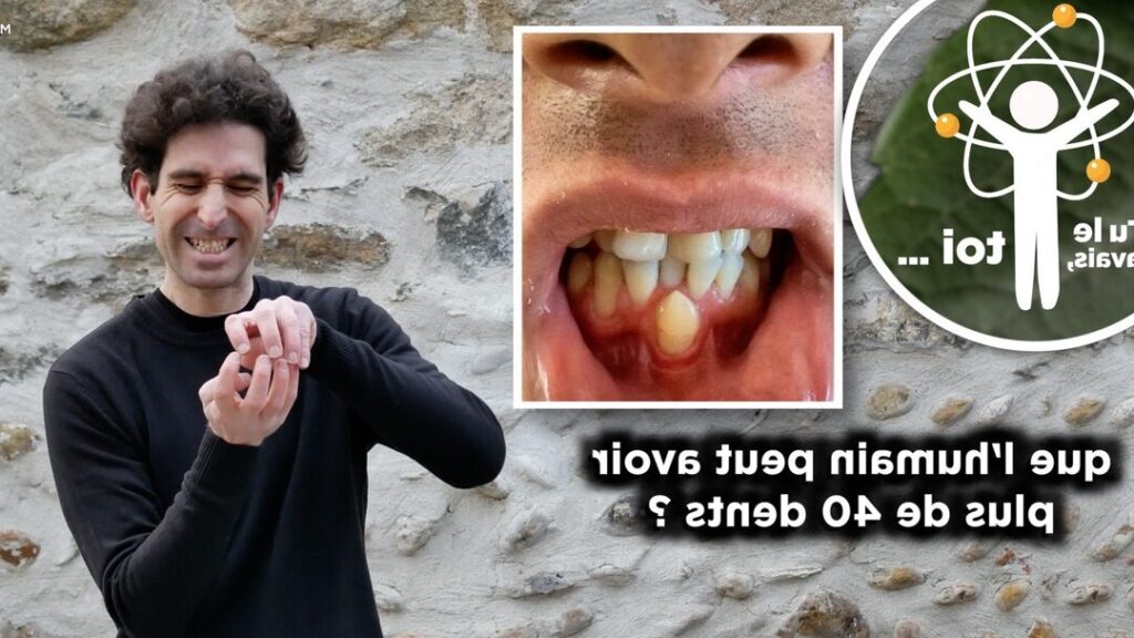 Est-il possible d’avoir plus de 32 dents ?