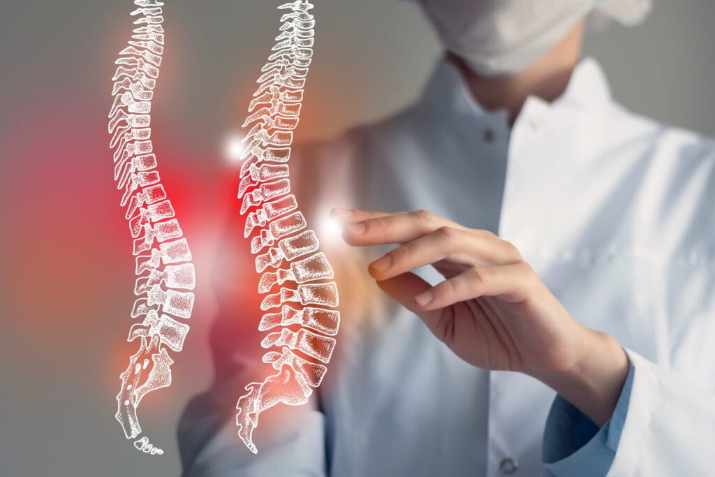Quel est le taux de réussite d’une arthrodèse lombaire ?