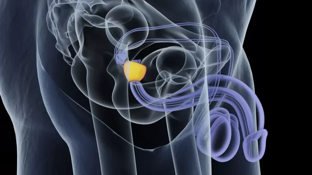 Stress et prostatite chronique : quel lien entre les deux ?